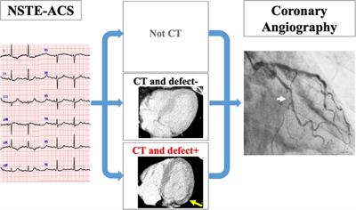 Impact of non-gated computed tomography on the timing of invasive strategy of patients with non-ST-elevation acute coronary syndrome